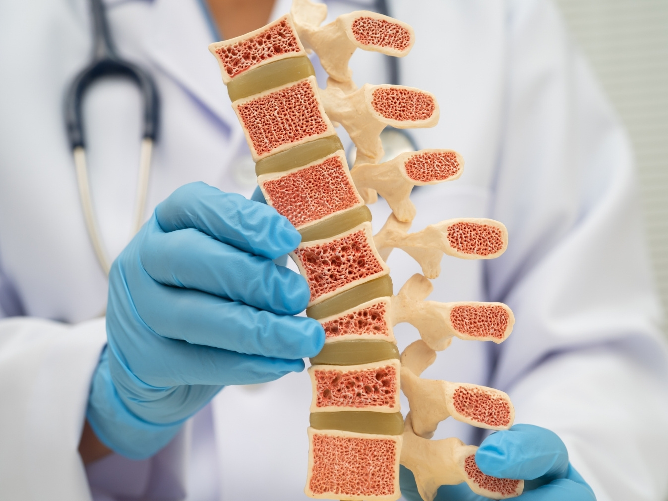 osteoporosis