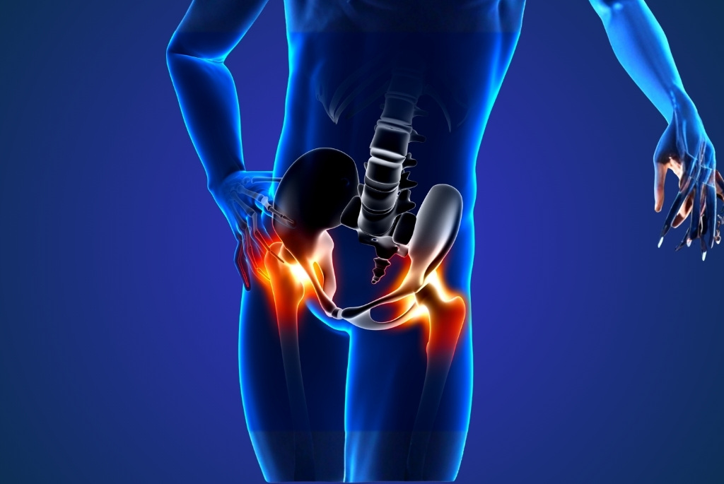 total hip repalcement