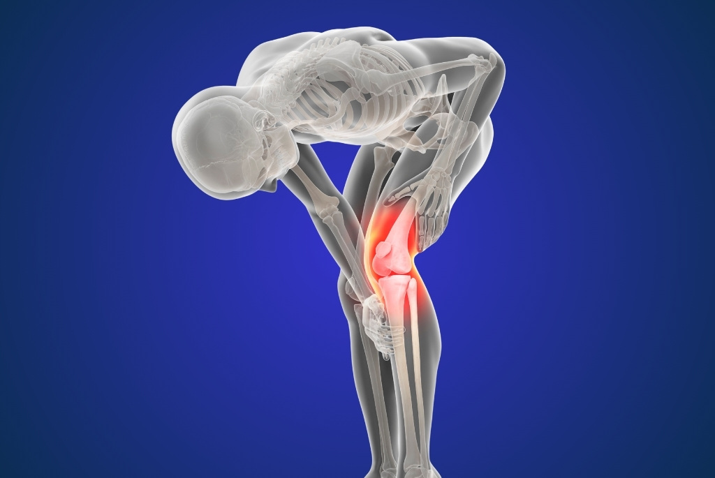 total knee replacement